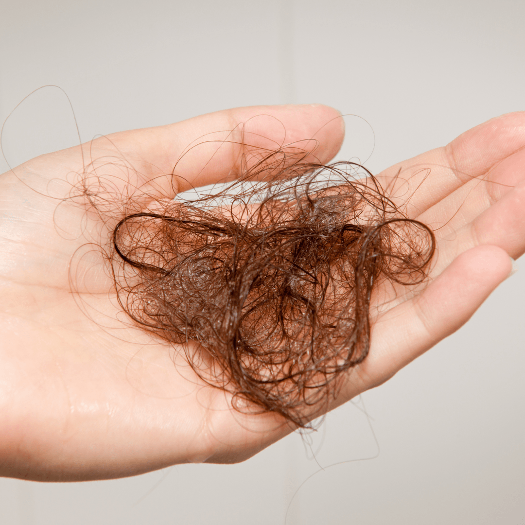 Alopecia: Sintomas, Causas e o Tratamento Natural Que Revoluciona a Saúde Capilar - QUANTIC FLORA