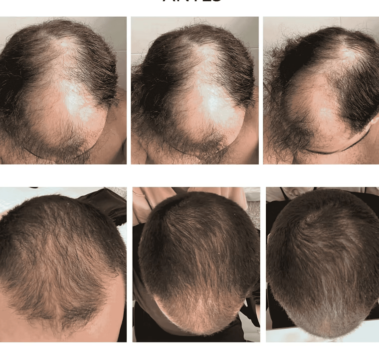 Óleo essencial de alecrim: o Minoxidil Natural - QUANTIC FLORA