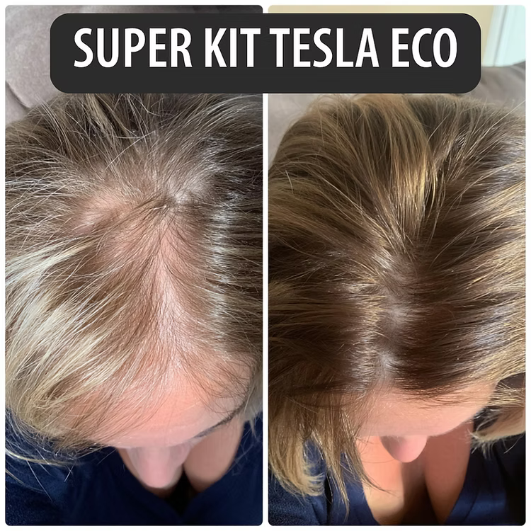 SUPER KIT TESLA ECO: FORÇA E RENOVAÇÃO INTENSA - CUIDADO 24 h - SEM SULFATO