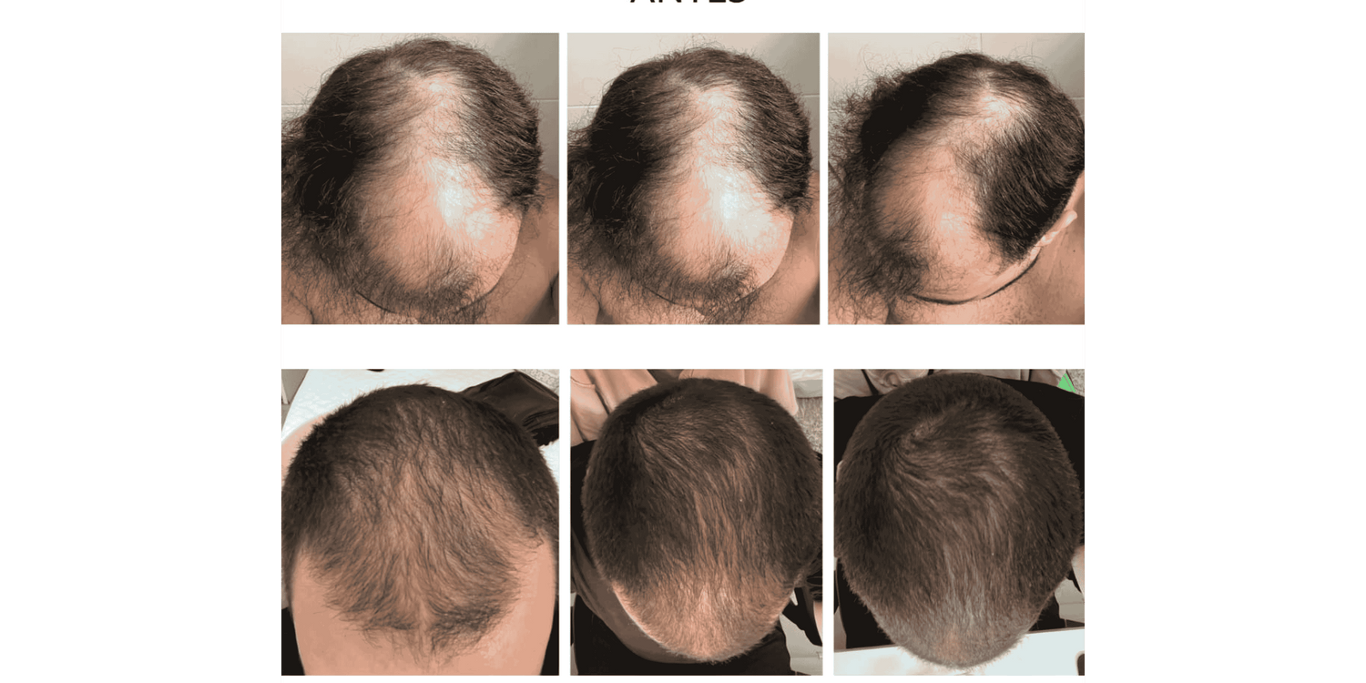 SUPER KIT TESLA: FORÇA E RENOVAÇÃO INTENSA - CUIDADO 24h - QUANTIC FLORA