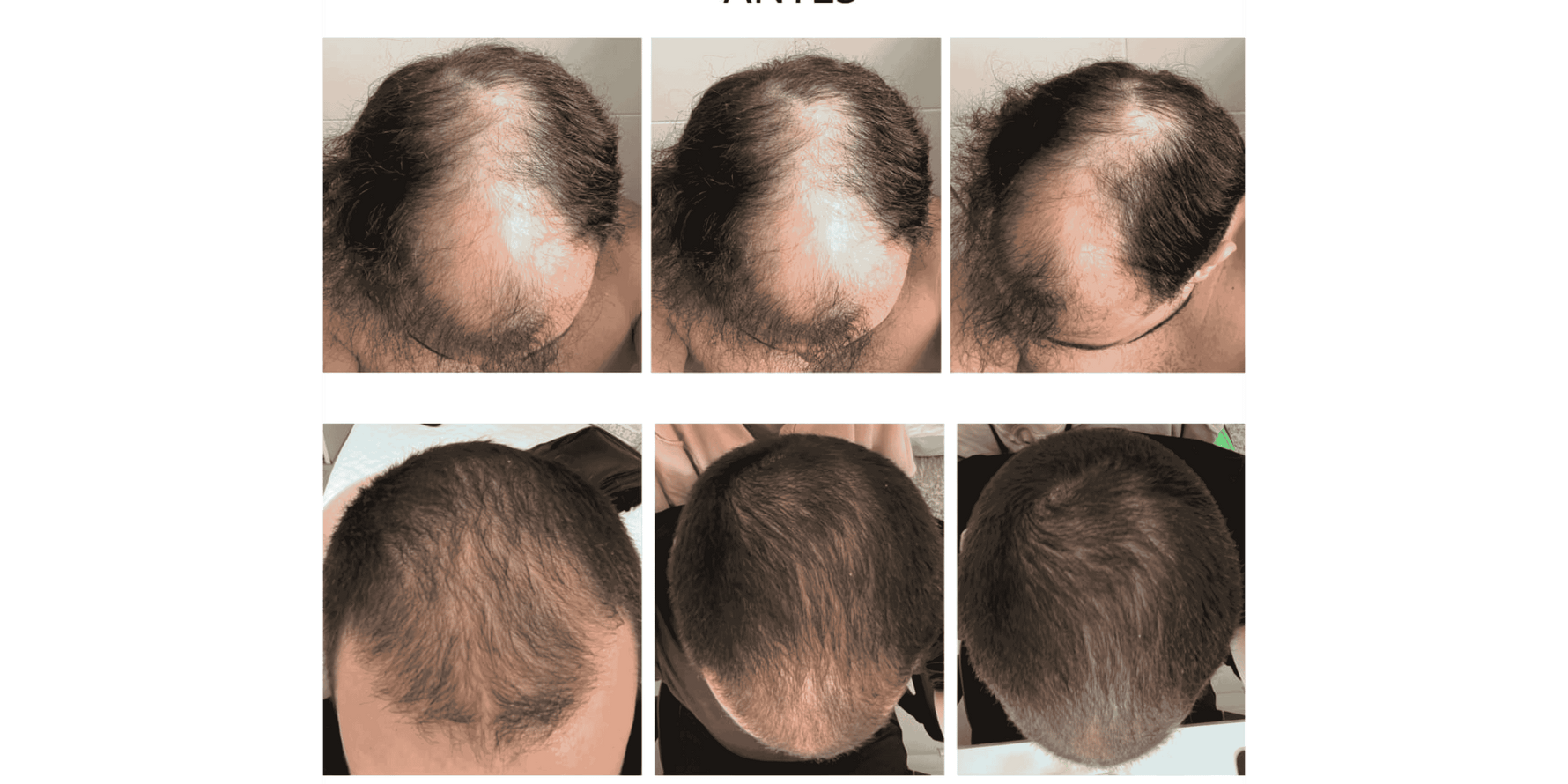 SUPER KIT TESLA: FORÇA E RENOVAÇÃO INTENSA - CUIDADO 24h - QUANTIC FLORA