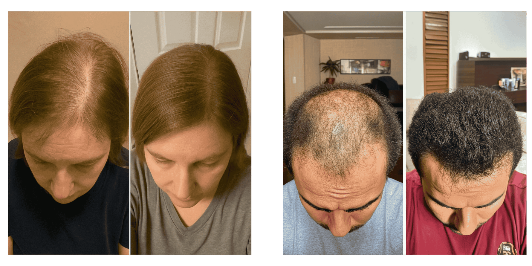 SUPER KIT TESLA: FORÇA E RENOVAÇÃO INTENSA - CUIDADO 24h - QUANTIC FLORA