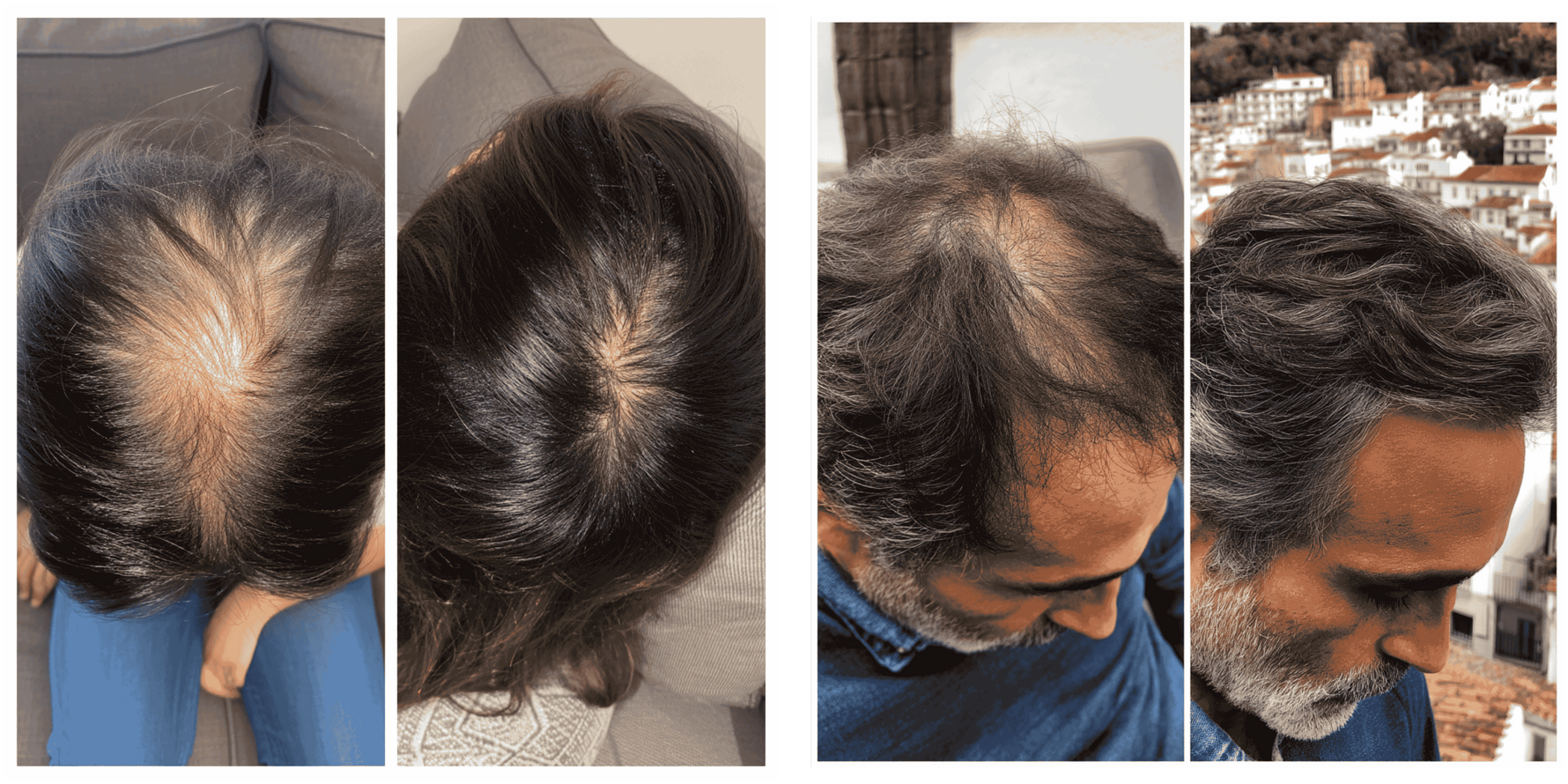 SUPER KIT TESLA: FORÇA E RENOVAÇÃO INTENSA - CUIDADO 24h - QUANTIC FLORA